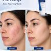 Panoxyl 10%  Acne Foaming Wash